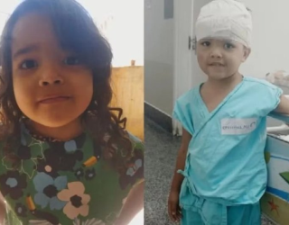 Menina de 4 anos � atacada na cabe�a por pit-bull