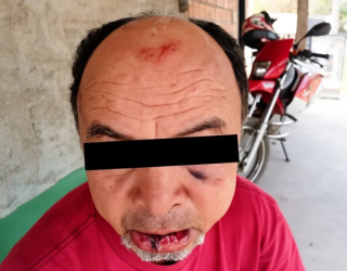 B�bado agride dono de bar ao n�o pagar conta e acaba sendo surrado