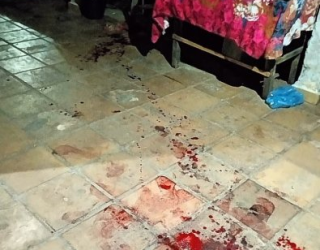 Mulher esfaqueia o marido ap�s ser agredida em briga por ci�mes