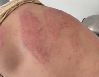 Homem � sequestrado e torturado por criminosos do Comando Vermelho em Mato Grosso